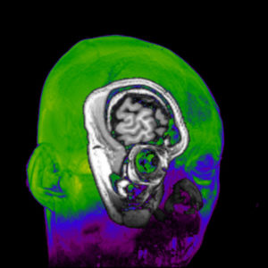 ARCHIVO | Los visuales de Daito Manabe y el doctor Yukiyasu Kamitami para mostrar las sensaciones que el cerebro desarrolla al escuchar música